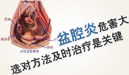 运城得了盆腔炎怎么治