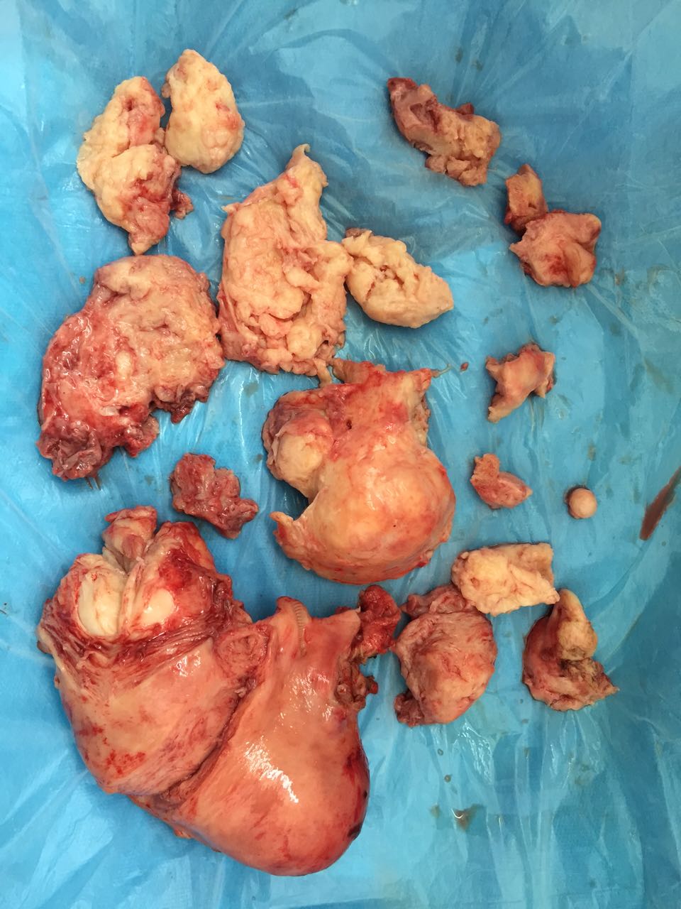 运城现代妇科医院