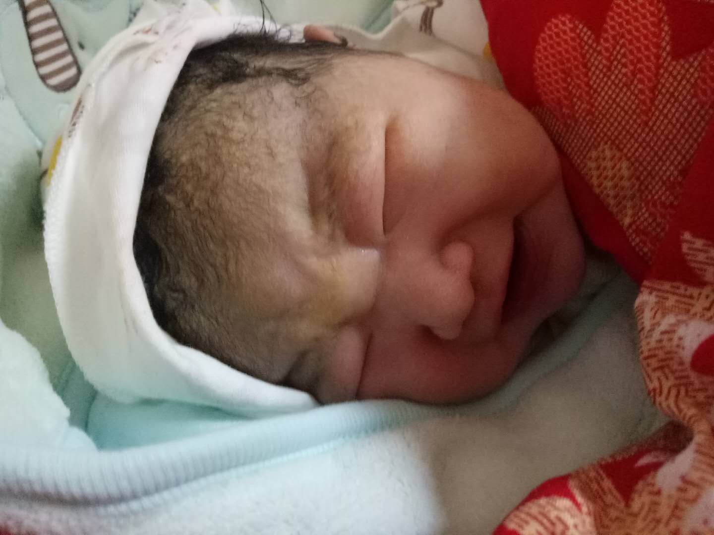 头条播报||运城现代导乐分娩成功顺产女婴